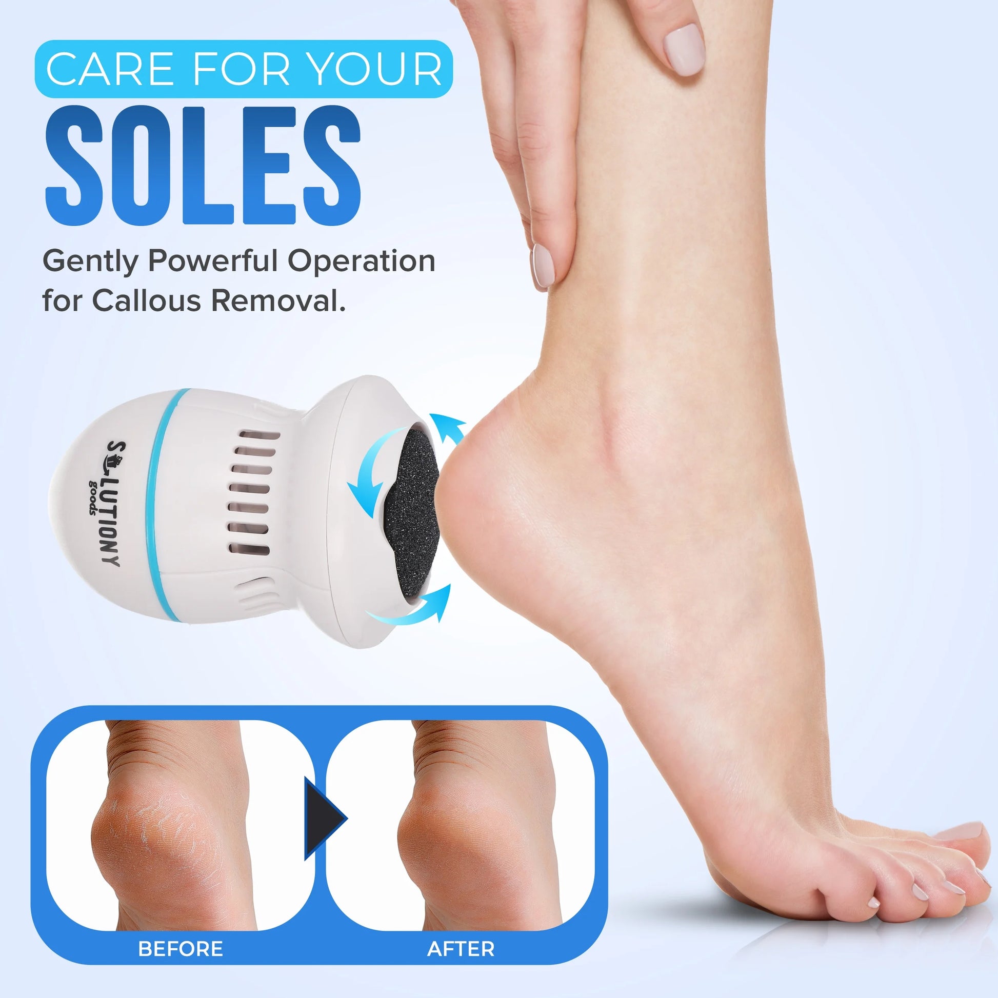 Electric Foot Callus Remover - Usb-Rechargeable Electric Callus Remover for Feet with Built-In Vacuum Removes Dead Skin from Feet, Portable Electric Foot File, White